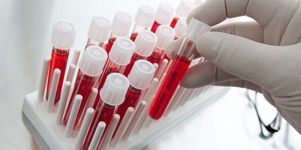 Mostra de sangue